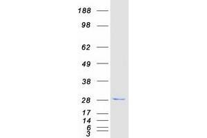 Validation with Western Blot
