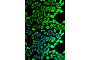 Immunofluorescence analysis of A549 cells using USP8 antibody (ABIN5974228). (USP8 anticorps)