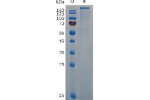 Mouse VWF (764-2813) Protein, His Tag on SDS-PAGE under reducing condition.