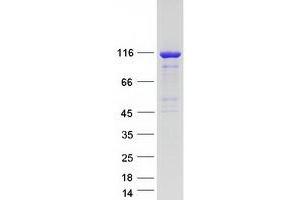 Validation with Western Blot