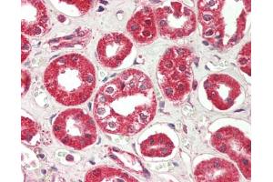 Human Kidney: Formalin-Fixed, Paraffin-Embedded (FFPE)