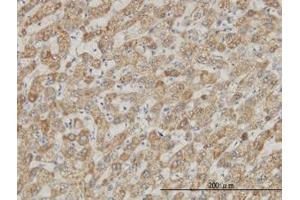 Image no. 1 for anti-DEAD (Asp-Glu-Ala-Asp) Box Polypeptide 56 (DDX56) (AA 450-548) antibody (ABIN599259) (DDX56 anticorps  (AA 450-548))