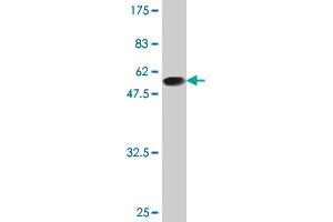 Western Blot detection against Immunogen (47. (BIN3 anticorps  (AA 1-199))