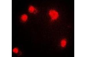 Immunofluorescent analysis of PRMT5 staining in HepG2 cells. (PRMT5 anticorps)
