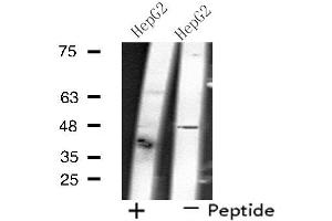 Western blot analysis of extracts from HepG2 cells, using SLC17A2 antibody.