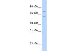 Western Blotting (WB) image for anti-Forkhead Box K1 (Foxk1) antibody (ABIN2461563) (Foxk1 anticorps)