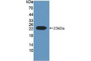 Western blot analysis of recombinant Human EFNA1. (Ephrin A1 anticorps  (AA 19-182))