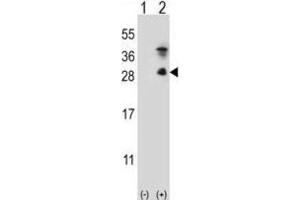 Western Blotting (WB) image for anti-Kallikrein 7 (KLK7) antibody (ABIN5022445) (Kallikrein 7 anticorps)