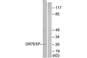 Western blot analysis of extracts from NIH-3T3 cells, using OR7E5P Antibody. (OR7E5P anticorps  (AA 35-84))