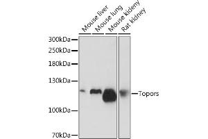 Western blot analysis of extracts of various cell lines, using Topors Rabbit pAb (ABIN7270855) at 1:1000 dilution. (TOPORS anticorps)
