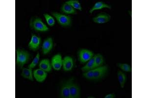 Immunofluorescence staining of A549 cells with ABIN7167453 at 1:100, counter-stained with DAPI.