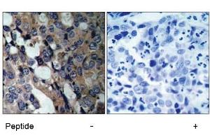 Image no. 1 for anti-Heat Shock 27kDa Protein 1 (HSPB1) (Ser15) antibody (ABIN197345) (HSP27 anticorps  (Ser15))