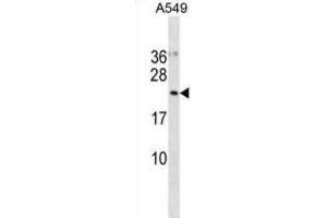 Western Blotting (WB) image for anti-Ubiquitin-Fold Modifier Conjugating Enzyme 1 (UFC1) antibody (ABIN3001127)