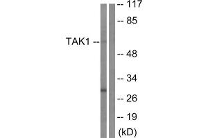 Western blot analysis of extracts from HepG2 cells, using TAK1 (epitope around residue 184) antibody. (TR4 anticorps  (Thr184))