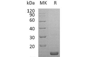 Western Blotting (WB) image for Interleukin 1 Receptor Antagonist (IL1RN) protein (ABIN7320549) (IL1RN Protéine)