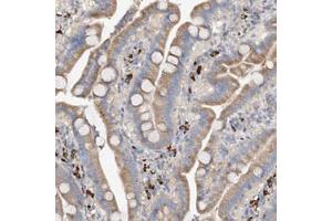 Immunohistochemical staining (Formalin-fixed paraffin-embedded sections) of human duodenum with SLC5A11 polyclonal antibody  shows moderate cytoplasmic positivity in glandular cells. (Solute Carrier Family 5 (Sodium/inositol Cotransporter), Member 11 (SLC5A11) anticorps)