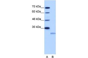 WB Suggested Anti-EIF4E2 Antibody Titration:  2. (EIF4E2 anticorps  (N-Term))