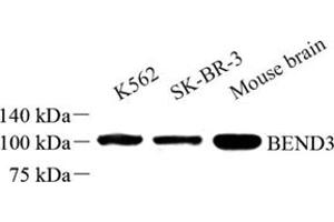 Western blot analysis of BEND3 (ABIN7073204) at dilution of 1: 500