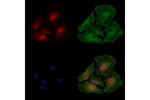 ABIN7094196 and ABIN7098242 staining  cells by IF/ICC.