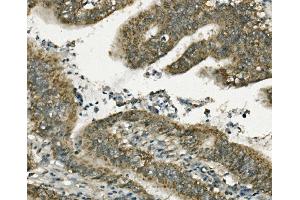 IHC analysis of FABP6 using anti-FABP6 antibody (ABIN7598974).