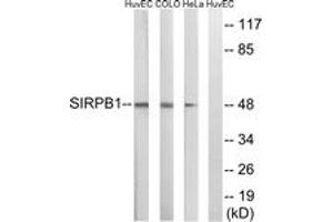 Western Blotting (WB) image for anti-Signal-Regulatory Protein beta 1 (SIRPB1) (AA 231-280) antibody (ABIN2890636) (SIRPB1 anticorps  (AA 231-280))