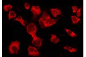 ABIN6278604 staining HT29 by IF/ICC.