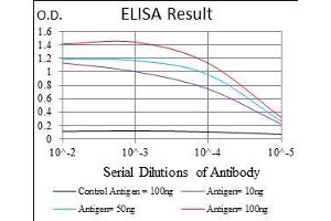 anti-Pleiomorphic Adenoma Gene-Like 1 (PLAGL1) (AA 118-222) antibody