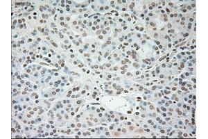 Immunohistochemical staining of paraffin-embedded pancreas tissue using anti-TNNI3mouse monoclonal antibody. (TNNI3 anticorps  (AA 1-210))