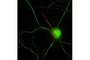 Double immunofluorescence staining of cultured rat hippocampal neurons with N56/21 (red) and MAP2 (green). (FGF14 anticorps  (AA 1-252))