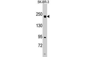 Western blot analysis of RICTOR polyclonal antibody  in SK-BR-3 cell line lysates (35 ug/lane). (RICTOR anticorps  (N-Term))