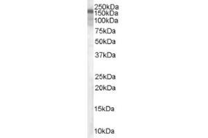 Image no. 1 for anti-Tuberous Sclerosis 1 (TSC1) (C-Term), (Isoform 1) antibody (ABIN374676) (TSC1 anticorps  (C-Term, Isoform 1))