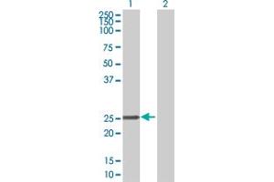 Western Blot analysis of CBX5 expression in transfected 293T cell line by CBX5 MaxPab polyclonal antibody. (CBX5 anticorps  (AA 1-191))