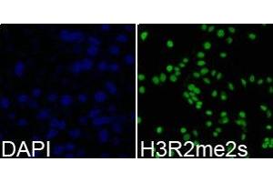 Immunofluorescence analysis of 293T cell using H3R2me2s antibody. (Histone 3 anticorps  (H3R2me2s))