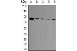 Western blot analysis of BCL11A expression in HT29 (A), Jurkat (B), Hela (C), A549 (D), mouse brain (E) whole cell lysates. (BCL11A anticorps)