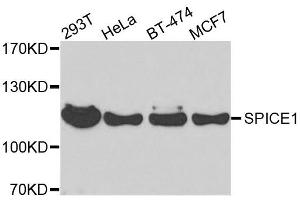 Western blot analysis of extracts of various cell lines, using SPICE1 antibody. (SPICE1 anticorps  (AA 1-220))
