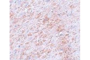 Immunohistochemistry (IHC) image for anti-Doublecortin-Like Kinase 2 (DCLK2) (C-Term) antibody (ABIN1030358) (DCLK2 anticorps  (C-Term))