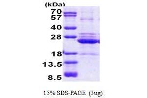 SDS-PAGE (SDS) image for HLA Class II DO alpha (HLA-DOA) (AA 26-217) protein (His tag) (ABIN5853061) (HLA-DOA Protein (AA 26-217) (His tag))
