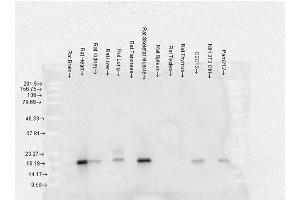 Western Blot analysis of Rat Brain, Heart, Kidney, Liver, Pancreas, Skeletal muscle, Spleen, Testes, Thymus cell lysates showing detection of Alpha B Crystallin protein using Mouse Anti-Alpha B Crystallin Monoclonal Antibody, Clone 3A10. (CRYAB anticorps  (PerCP))