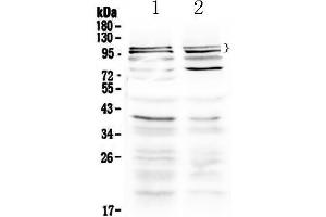 Western blot analysis of TRPC3 using anti-TRPC3 antibody . (TRPC3 anticorps  (AA 718-770))