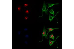 ABIN6265229 and ABIN6278529 staining 3 by IF/ICC. (SOX11 anticorps  (C-Term))