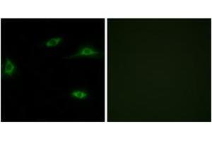 Immunofluorescence analysis of LOVO cells, using OR2T11 Antibody. (OR2T11 anticorps  (AA 51-100))