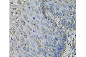 Immunohistochemistry of paraffin-embedded Human esophagus using IL1A Polyclonal Antibody at dilution of 1:100 (40x lens). (IL1A anticorps)