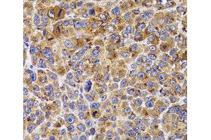 Immunohistochemistry of paraffin-embedded Mouse cancer using UBE2R2 Polyclonal Antibody at dilution of 1:100 (40x lens). (UBE2R2 anticorps)