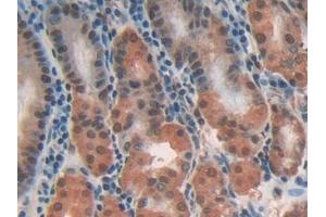 Detection of CLIC1 in Human Stomach Tissue using Polyclonal Antibody to Chloride Intracellular Channel Protein 1 (CLIC1)