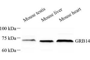 Western blot analysis of GRB14 (ABIN7074135) at dilution of 1: 500 (GRB14 anticorps)