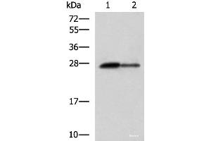Western blot analysis of Rat pancreas tissue and Mouse pancreas tissue lysates using CTRB1 Polyclonal Antibody at dilution of 1:1000 (CTRB1 anticorps)