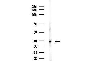 Western blot analysis of lysates from EC304 cells, using GAL Antibody at 1/1000 dilution.