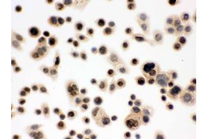 IHC analysis of p95 NBS1 using anti-p95 NBS1 antibody .