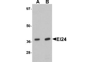 Western blot analysis of EI24 in rat liver tissue lysate with EI24 antibody at (A) 1 and (B) 2 µg/mL. (EI24 anticorps  (C-Term))