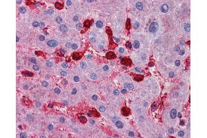 Immunohistochemistry (IHC) image for anti-Mitogen-Activated Protein Kinase Kinase Kinase Kinase 4 (MAP4K4) (N-Term) antibody (ABIN2783612)